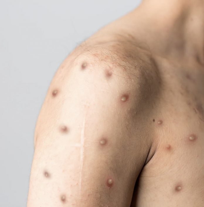 9C4C906B-F4C9-4013-B9F4-DA33ACEB02F4