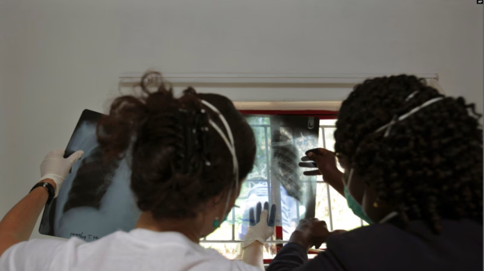 La OPS insta a intensificar los esfuerzos para combatir la tuberculosis en las Américas y aboga por un compromiso renovado para eliminar la enfermedad como amenaza para la salud pública. Foto: Cortesía.