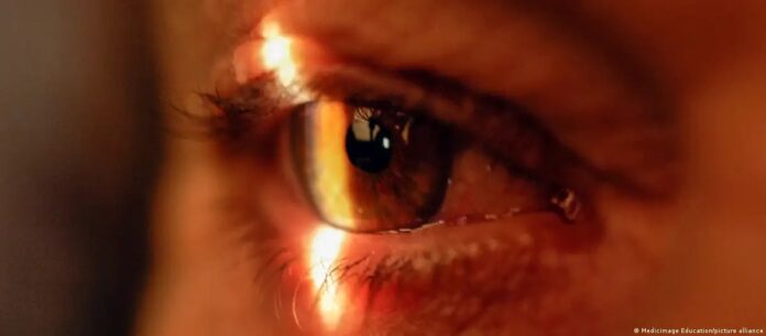 Imagen de referencia.