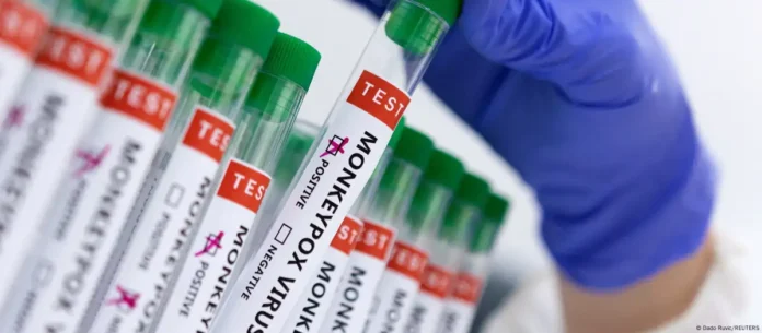 Tubos de ensayo con la etiqueta “Virus de la viruela del mono” con marcas para “positivo” o “negativo”. Imagen de referencia. Foto: Cortesía.