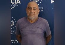 Detienen a conductor sin licencia acusado de provocar accidente que dejó a motociclista lesionado en San Miguel